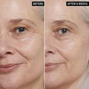 Anua retinol cream - Reduce Wrinkle, fine lines & Hyperpigmentation - Guaranteed Results
