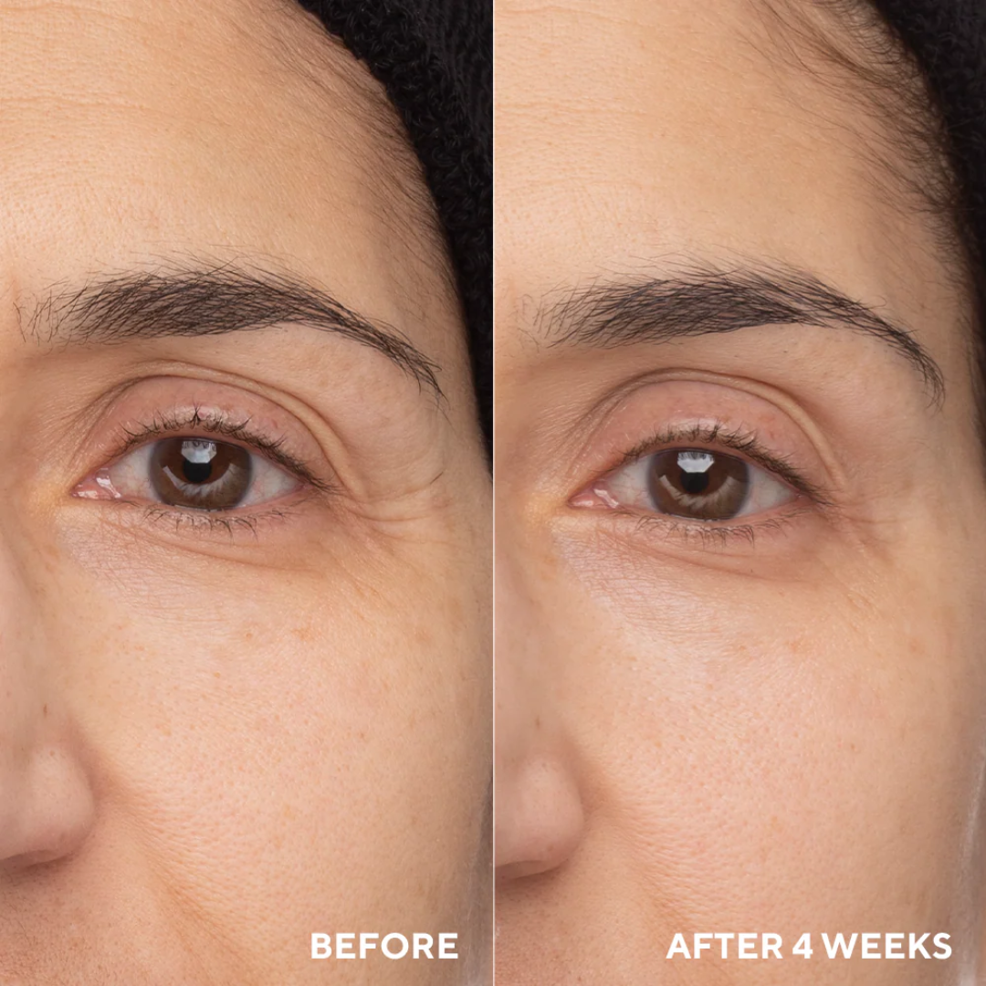 Anua retinol cream - Reduce Wrinkle, fine lines & Hyperpigmentation - Guaranteed Results
