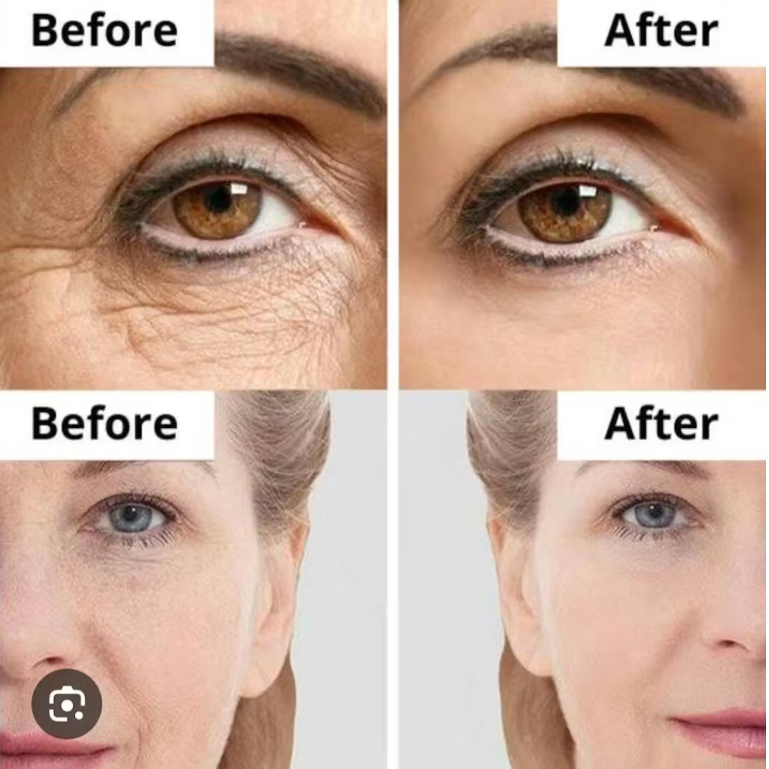 Anua retinol cream - Reduce Wrinkle, fine lines & Hyperpigmentation - Guaranteed Results