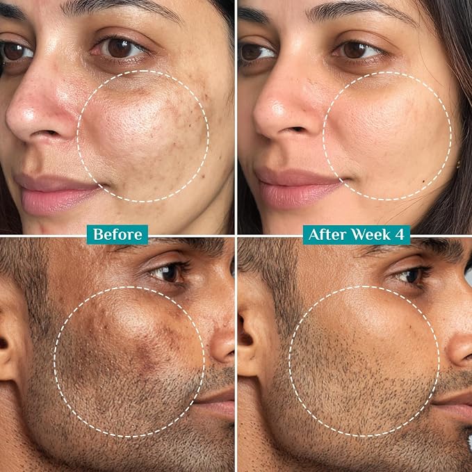 🎁 Buy 1 Get 2 FREE — Get 3 Serums for Only Rs. 1,549 Pilgrim 15% Vitamin C Face Serum – With Ferulic Acid & Australian Kakadu Plum | Advanced Brightening Serum