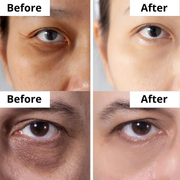 Anua retinol cream - Reduce Wrinkle, fine lines & Hyperpigmentation - Guaranteed Results