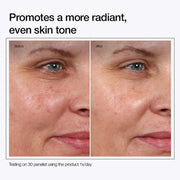 Glycolic Acid 7% Toning Solution(buy 1 get 1 free)
