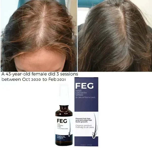 FEG PLUS Hair Growth Spray
