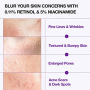 Anua retinol cream - Reduce Wrinkle, fine lines & Hyperpigmentation - Guaranteed Results