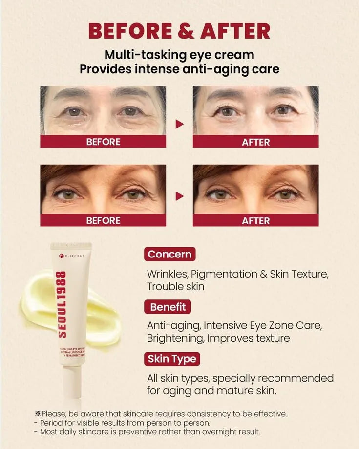 SEOUL 1988 Eye Cream – Retinal Liposome 4% + Fermented Bean